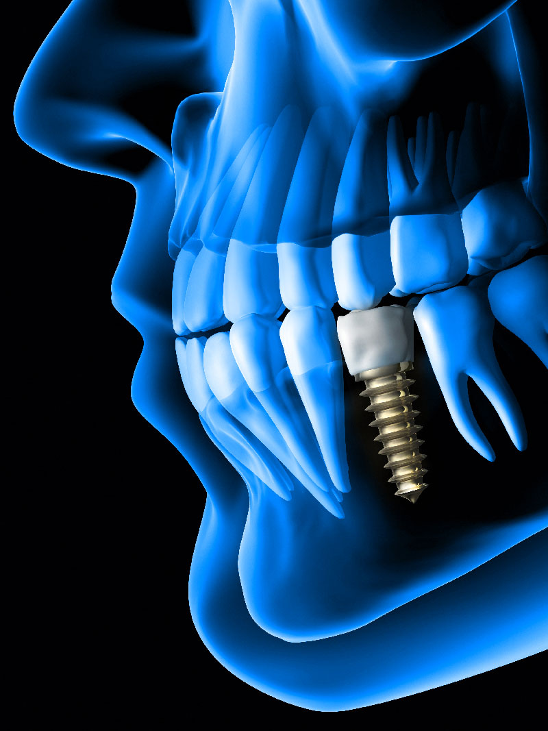 studio-dentistico-bina-25