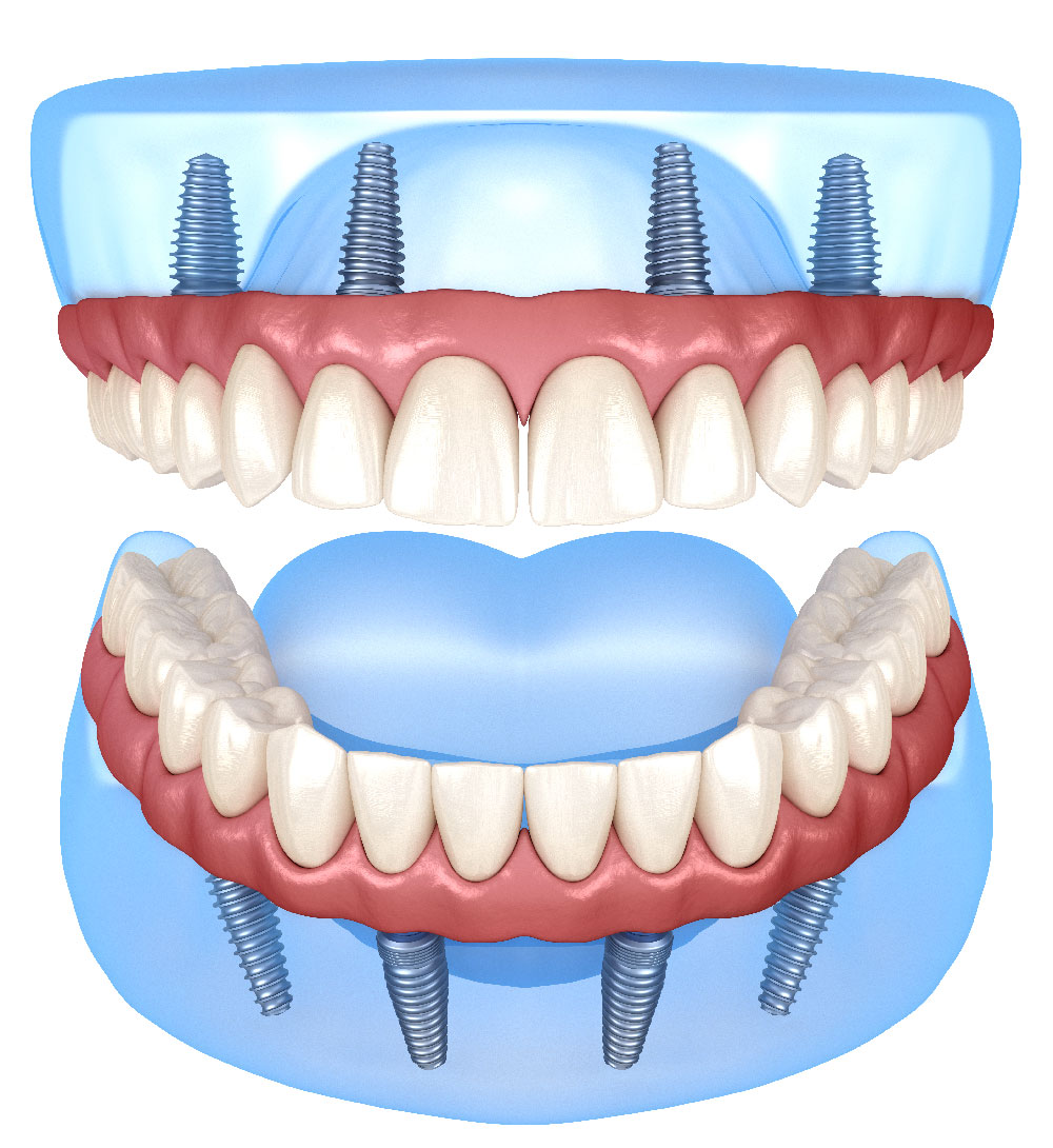 studio-dentistico-bina-26