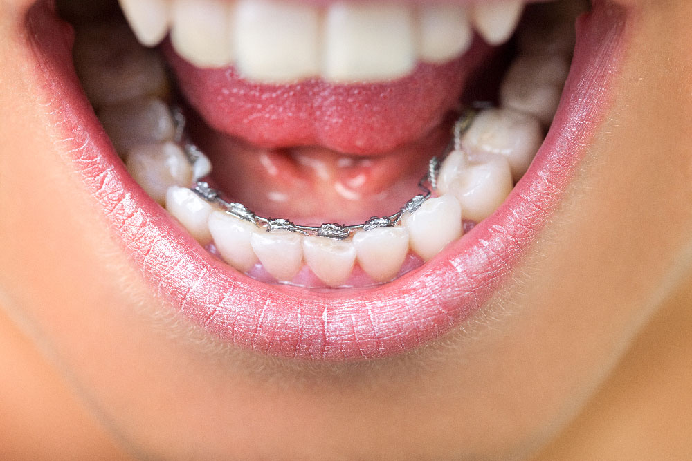 studio-dentistico-bina-32