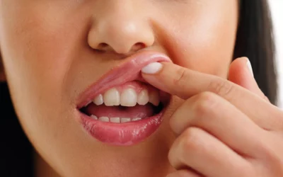Gengivite o piorrea? La differenza che può salvarti i denti